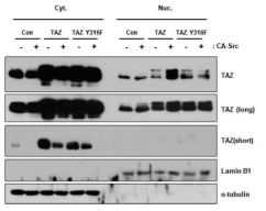 Src에 의한 TAZ의 핵으로의 localization변화가 TAZ Y316 mutant에서는 관찰되지 않음