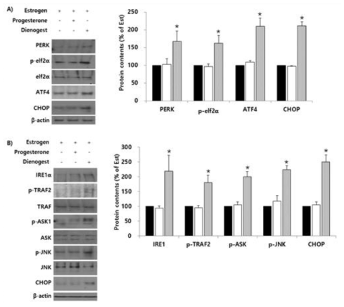 디에노게스트-매개 ER stress는 PERK, IRE1 signaling을 통해 CHOP 발현을 조절함