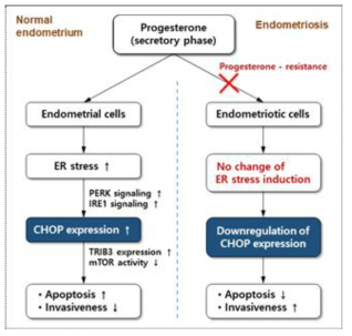 정상 및 자궁내막증 세포에서 ER stress-매개 세포사멸, 증식 및 침습의 조절기전