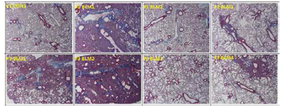 Bleomycin 으로 유도한 폐섬유화 마우스 모델에서의 collagen deposition 확인