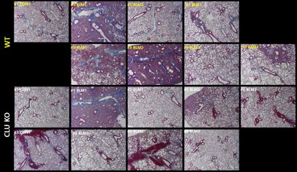 Bleomycin 유도 마우스 폐섬유화에서 collagen deposition 확인