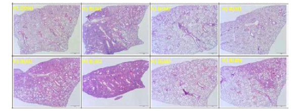 Bleomycin 으로 유도한 폐섬유화 마우스 모델에서의 염증반응 확인