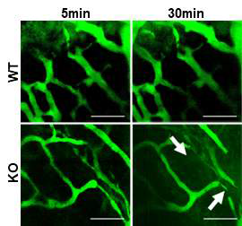Dextran 2-photon imaging을 이용한 뇌혈관장벽 투과성 증가