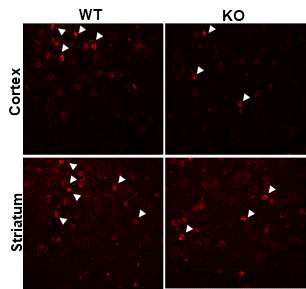 희소돌기아교세포 (Oligodendrocyte) 발현 관찰