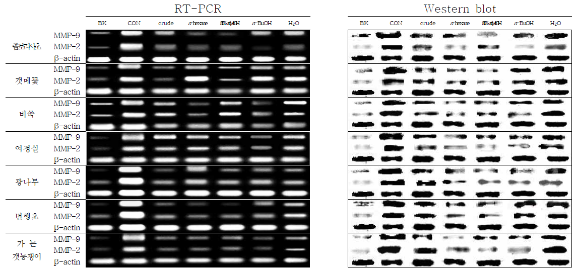 RT-PCR과 western blot을 통한 MMP-9, MMP-2 인자 발현 측정 결과