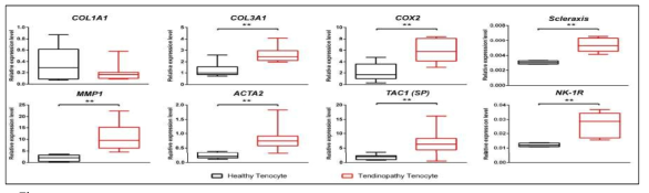 Differential gene expressions between healthy tenocyte and tendinopathy tenocyte. Relative expressions by qRT-PCR of 8 genes were analyzed using cultured tenocytes. Results show that levels of COL3A1, MMP1, COX2, SCX, ACTA2, TAC1 (SP), and NK-1R were significantly increased in the cells cultured from tendinopathy tenocyte. However, COL1A1 was decreased in the cells cultured from tendinopathy tenocyte without statistical significance