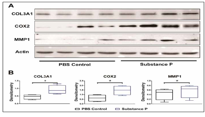 SP induced the development of tendinopathy at protein level. The results were consistent with the analysis of qRT-PCR (A); Densitometric analysis, as expected, revealed that COL3A1, COX2, and MMP1 protein band intensities normalized to actin were increased