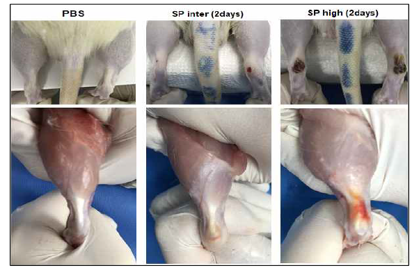 Morphological change after substance P injection. Four weeks after substance P injection in the achilles tendon, the rats were euthanized by CO2 inhalation. Grossly the skin became dark and red with swelling. After disssection the tendon was closely looked. The tendon becomes hemorrhagic, fliable, and thicker but the PBS control had the normal appearance. The changes were more ane more in proportion to the substance P dose