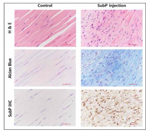 Rat achilles tendon에 substance P injection 후 tendinopathy에 해당하는 조직학적 변화가 관찰됨. (x400)