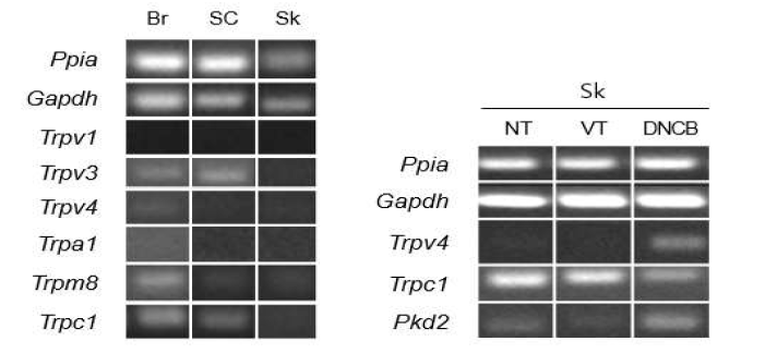 정상 CBA/J 생쥐의 조직별 Trp 이온통로 유전자 발현(왼쪽)과 자극 후 피부 조직에서의 Trp 이온통로 유전자 발현 변화 (오른쪽)