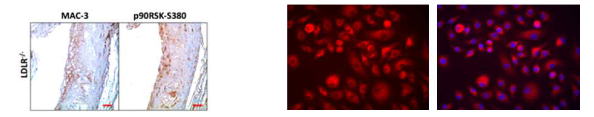 p90RSK activation in atherosclerotic plaque