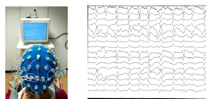 Neural Complexity측정을 위한 EEG신호획득
