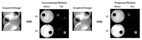 개발한 Chemical Shift Imaging 기법