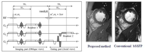 고속의 촬영기법을 기반으로 만든 심장 자기공명 영상