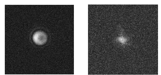 SPGR (좌)과 SSFP (우)기반의 UTE를 이용한 phantom 영상 (sodium, 7T MRI)