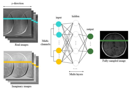 aliasing artifacts 제거를 위한 인공 신경망 기반의 알고리즘