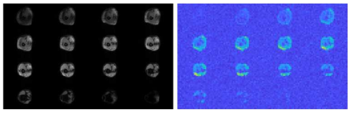 7T MRI에서 획득한 다리 영상 (좌) proton 영상 (우) 31P 영상
