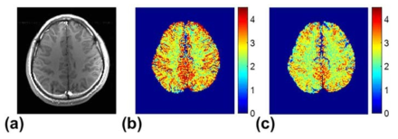 (a) T1-weighted 영상, (b) SSFP 기반의 CEST 영상, (c) SPGR 기반의 CEST 영상