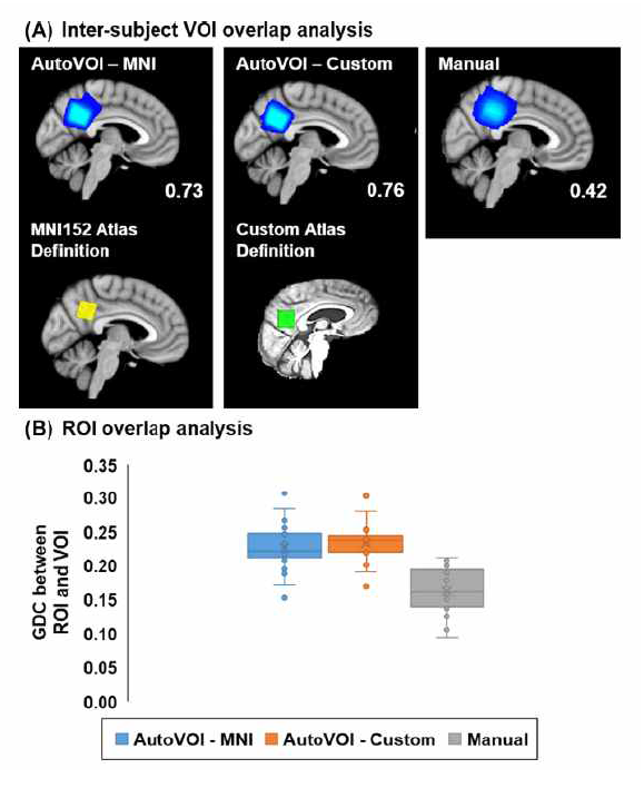 사람이 수동으로 수행한 위치선정 (manual) 결과와 제안하는 방법을 이용해 자동으로 수행한 위치선정 (AutoVOI – MNI, Custom)의 정량적 성능 비교