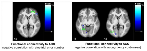real tDCS군에서 ACC영역의 기능적 뇌연결성 변화와 전두엽 실행기능 간 상관관계