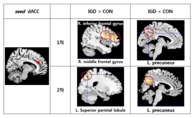 dACC와 뇌기능 연결성 차이를 보이는 영역