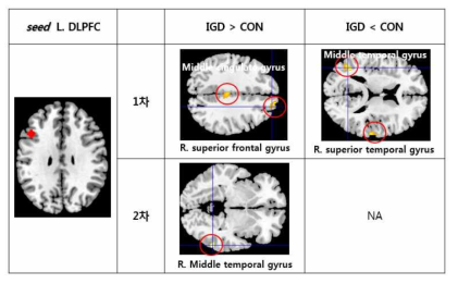 좌측 DLPFC와 뇌기능 연결성 차이를 보이는 영역
