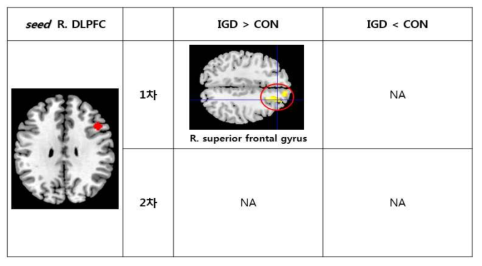 우측 DLPFC와 뇌기능 연결성 차이를 보이는 영역