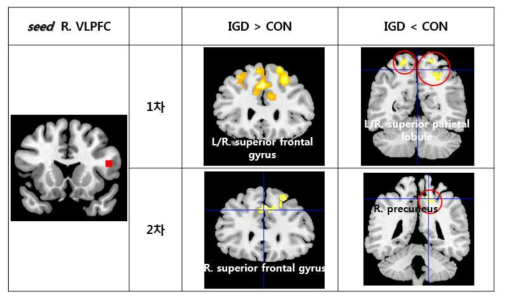 우측 VLPFC와 뇌기능 연결성 차이를 보이는 영역