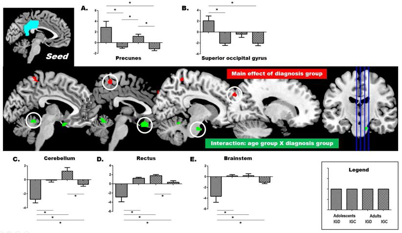 PCC 영역과 뇌기능연결성을 보이는 뇌 영역