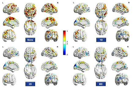 각 조건에서 관찰되는 집단 간 뇌활성화 차이