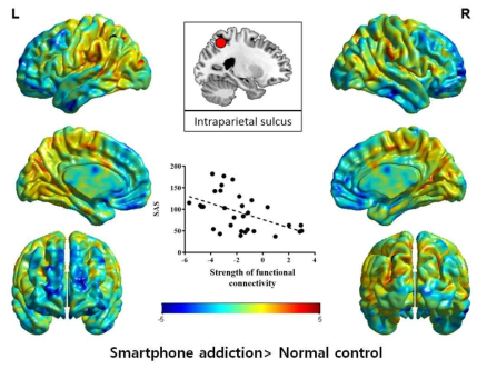 스마트폰 과의존과 내측두엽-전두엽간 뇌기능연결성 지표의 상관관계