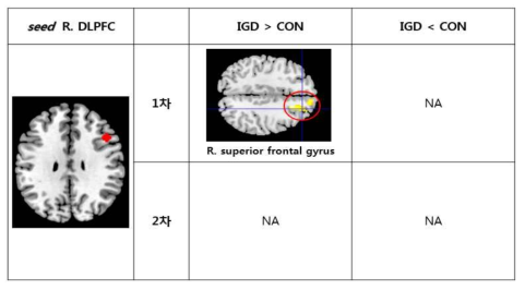 우측 DLPFC와 뇌기능 연결성 차이를 보이는 영역