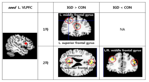 좌측 VLPFC와 뇌기능 연결성 차이를 보이는 영역