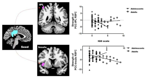 연령 집단과 IGD 척도 점수와의 상호작용 효과를 보이는 뇌 영역