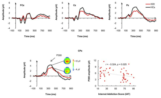 인터넷 게임 중독군과 정상 대조군에서 deviant tone 청각자극에 대한 grand-averaged ERP waveforms (위쪽), centro-midline에서 P300 진폭의 그룹간 차이 양상 (아래쪽 좌측) 및 인터넷 중독 임상증상과의 부적 상관 관계 (아래쪽 우측)