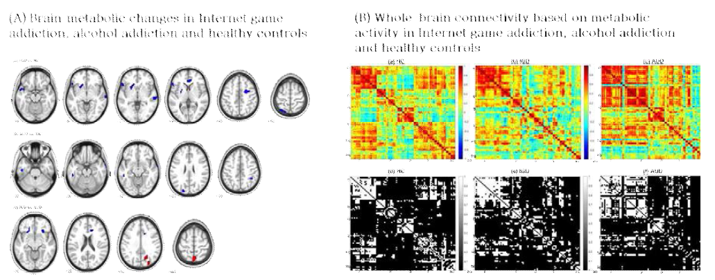 인터넷·게임 중독의 뇌 당대사 기능 이상 및 뇌 연결성 변화 규명: 알코올 중독 및 정상대조군과의 비교 연구