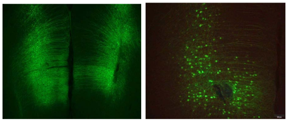 Medial prefrontal cortex에서 발현되는 channel rhodopsin. Indicator 단백질인 GFP 염색이 mPFC 세포에서 잘 관찰되었음. 왼쪽: 4x, 오른쪽: 10x