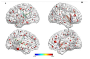 제안한 방법의 Brain connectivity 분석 결과 (FDP=0.1 제어하에서 4005개의 잠재적 연결 중에 17개의 significant한 뇌연결성을 찾아냄)