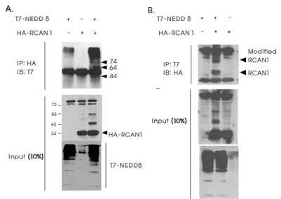동물 HEK293 세포주에서 RCAN1과 NEDD8의 결합을 확인