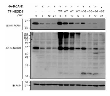 일차신경배양세포에서 RCAN1 단백의 NEDD8 수식화 후 단백 안정성 변화를 분석