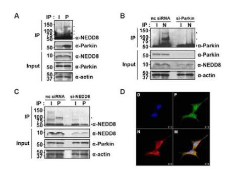 파킨슨병 유발 병인 단백 parkin과 NEDD8의 공유 수식화 결합 확인