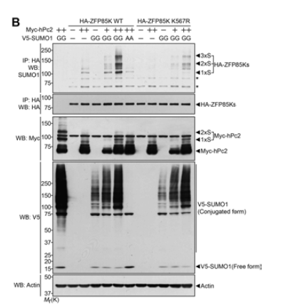 ZFP85K 다양한 라이신 잔기의 돌변변이 체중 SUMOylation이 되는 정도를 측정함