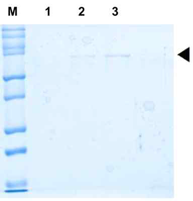 parkin-ISG15 결합단백질 정제
