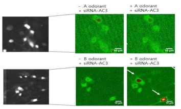 + siRNA-Gaolf and + siRNA-AC3 / Ca2+ level