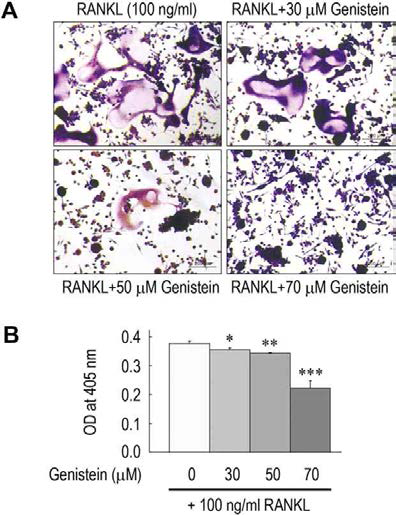 대식세포에서 RANKL 유도성 파골세포 형성에 대한 genistein의 억제 효과