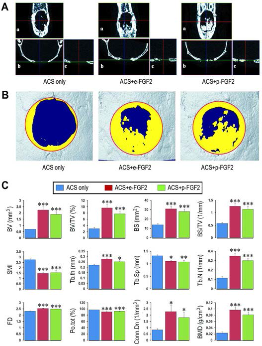 손상된 두개골에서의 신생골 합성에 대한 microCT 분석