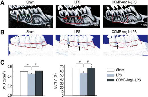 국소적 COMP-Ang1 처치에 따른 LPS/ligature 유도성 치조골 소실의 억제. (A) 2D μCT images. (B) 3D μCT images of alveolar bone. (C) 골밀도 및 골량
