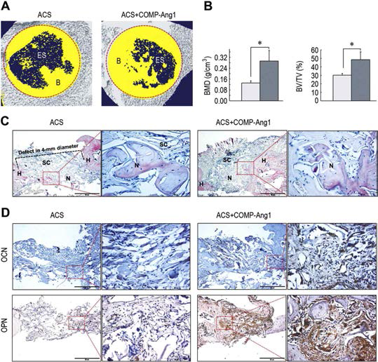하악골이 손상된 동물모델에 있어서 COMP-Ang1 처리에 의한 골형성 촉진 효과