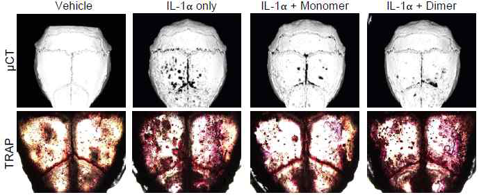 The effects of VnP-16 on IL-1-induced bone destruction in vivo. A collagen sponge treated with vehicle (DDW), IL-1 (2 μg), synthetic peptides (125 μg), or synthetic peptides (125 μg) plus IL-1 (2 μg) was implanted over the calvarial bone of 5-week-old ICR mice. μCT imaging and TRAP staining of whole calvariae were performed; the black spots indicate eroded surfaces