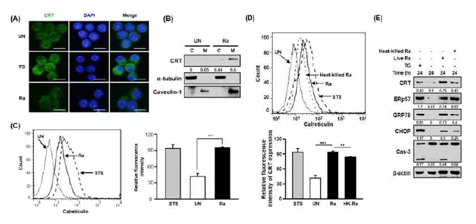 살아있는 결핵균 감염에 의한 샤페론 단백질 CRT의 세포 내 위치이동